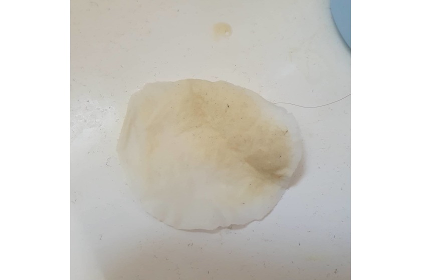 A cotton pad showing the dirt that using a toner removes from skin